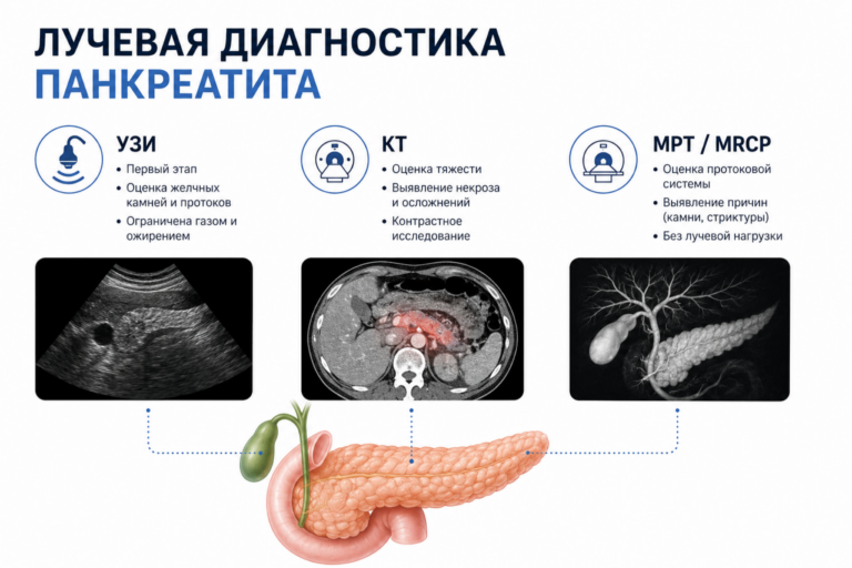 Лучевая диагностика панкреатита: КТ, МРТ и УЗИ в клинической практике